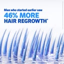 Regaine Hair Loss Treatment Mens Extra Strength 1 Month - 60ml thumbnail 13