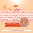 John Plunkett's Sunspot Cream 100g thumbnail 11