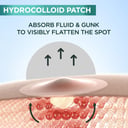 Garnier Pure Active Pimple Patch 22 Pack - 1 unit thumbnail 4