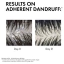 Dercos Anti-Dandruff Shampoo - Sensitive Scalp 200ml thumbnail 3