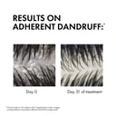 Dercos Anti-Dandruff Dandruff Shampoo - Dry Hair 390ml thumbnail 5