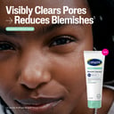 Cetaphil Blemish Cleanser 124ml thumbnail 8