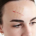 Leukostrip Wound Closure Strips 6.4mm X 76mm - 3 pack thumbnail 3