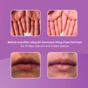 Ego QV Dermcare Sting-Free Ointment 100g thumbnail 3