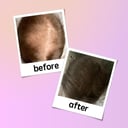 Georgiemane Hairgrowth Spray 100ml thumbnail 5