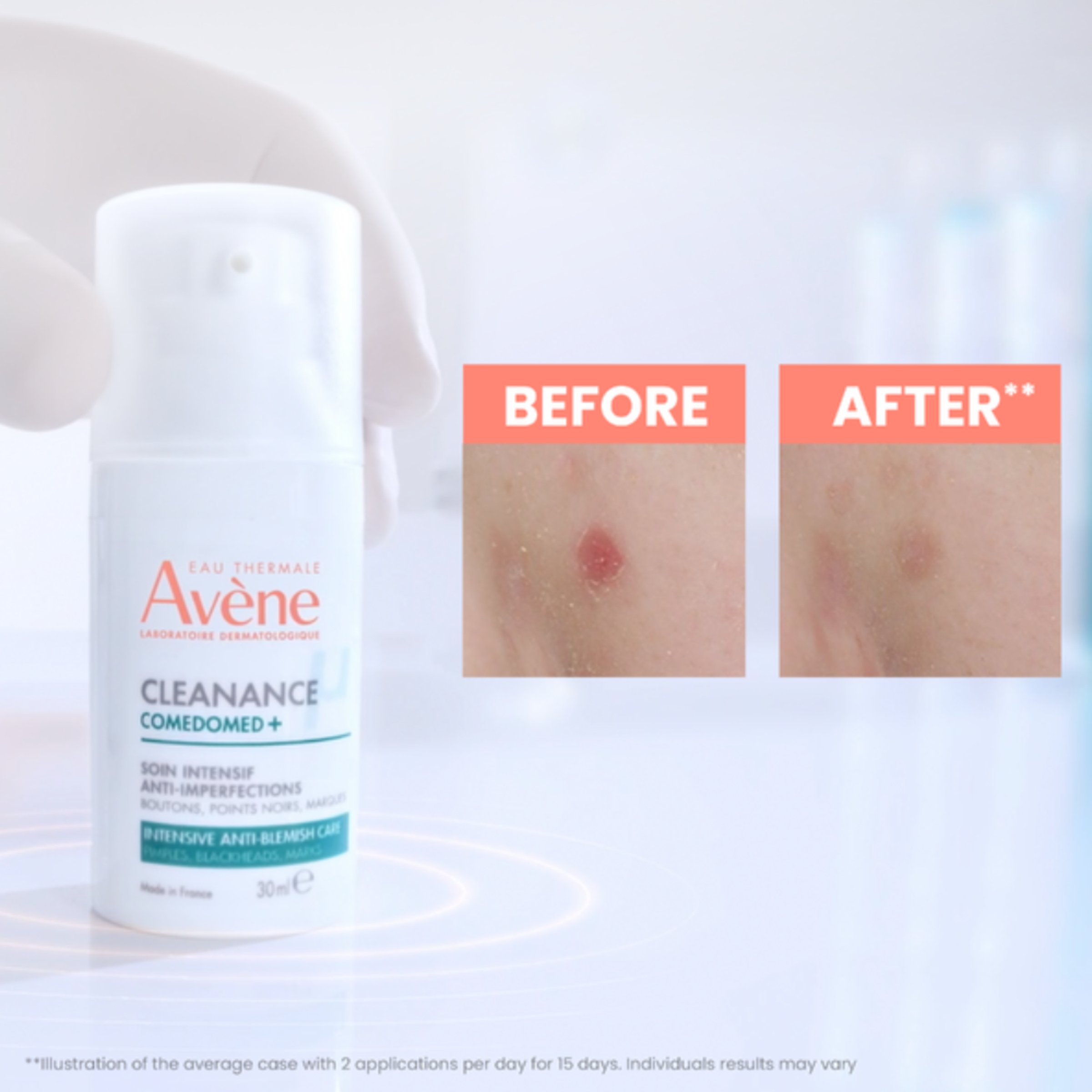 Avene Cleanance Comedomed 30ml - Image 3
