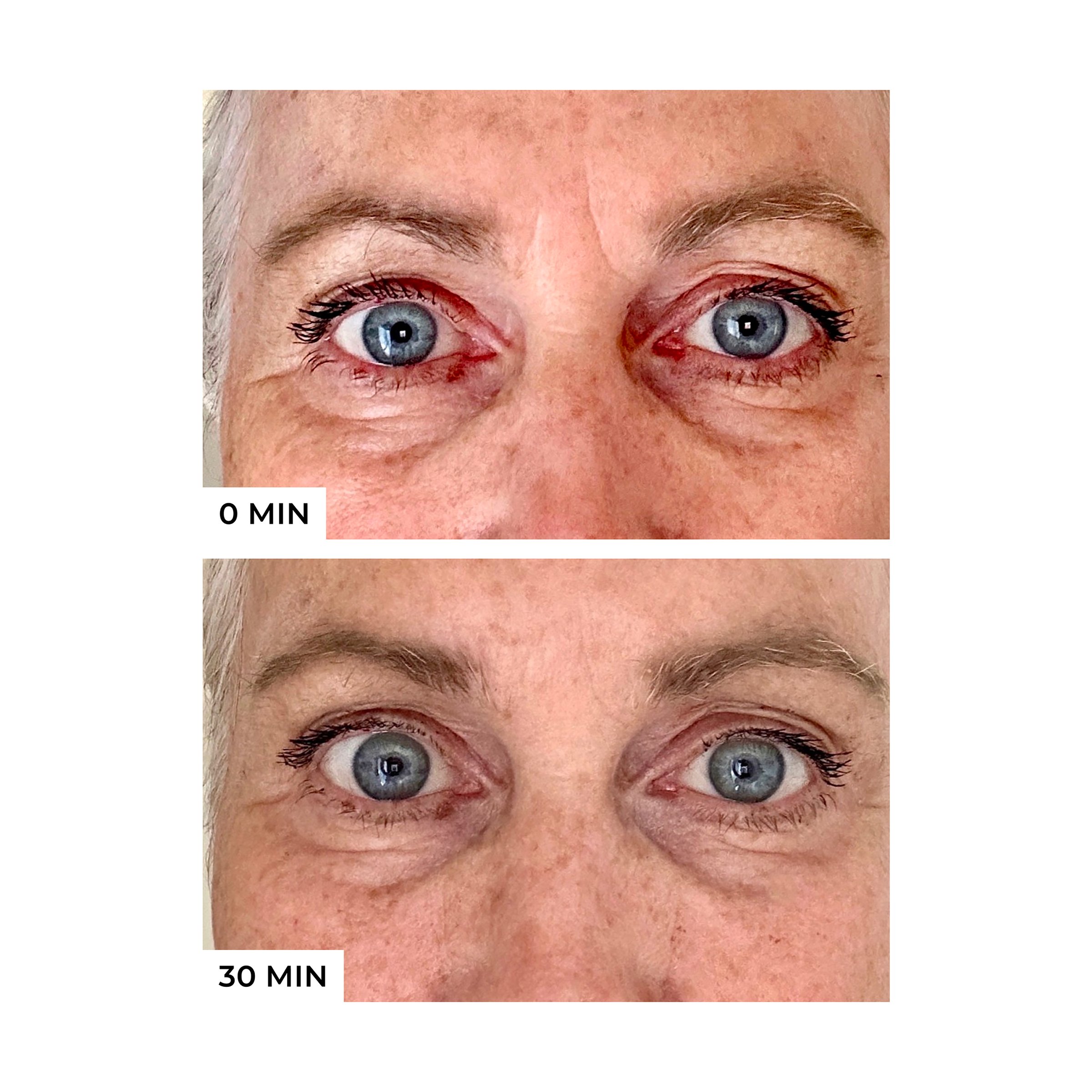 freezeframe 48 Hour Wrinkle Freeze 60ml - Image 2