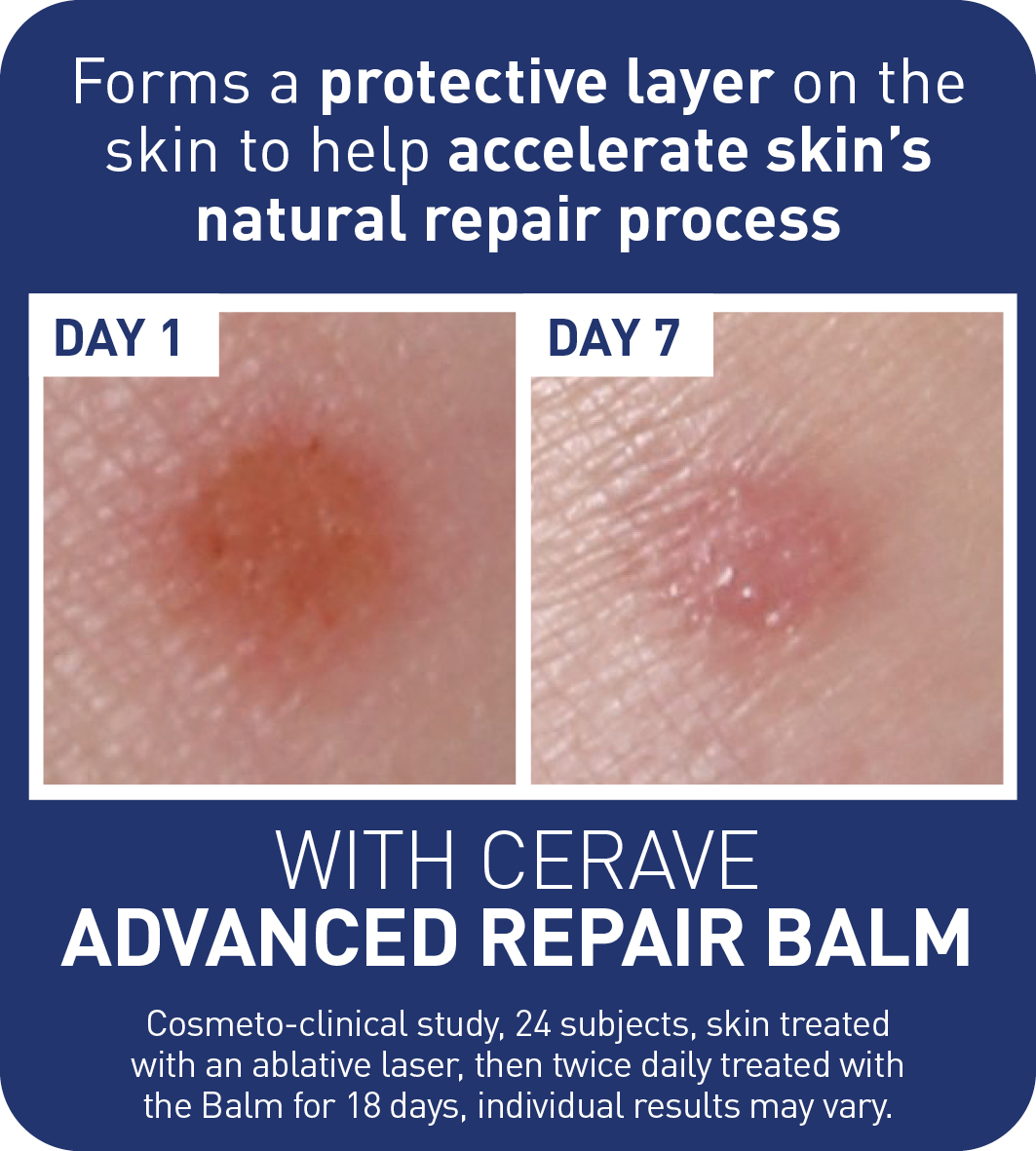 CeraVe Advanced Repair Balm 50ml - Image 5