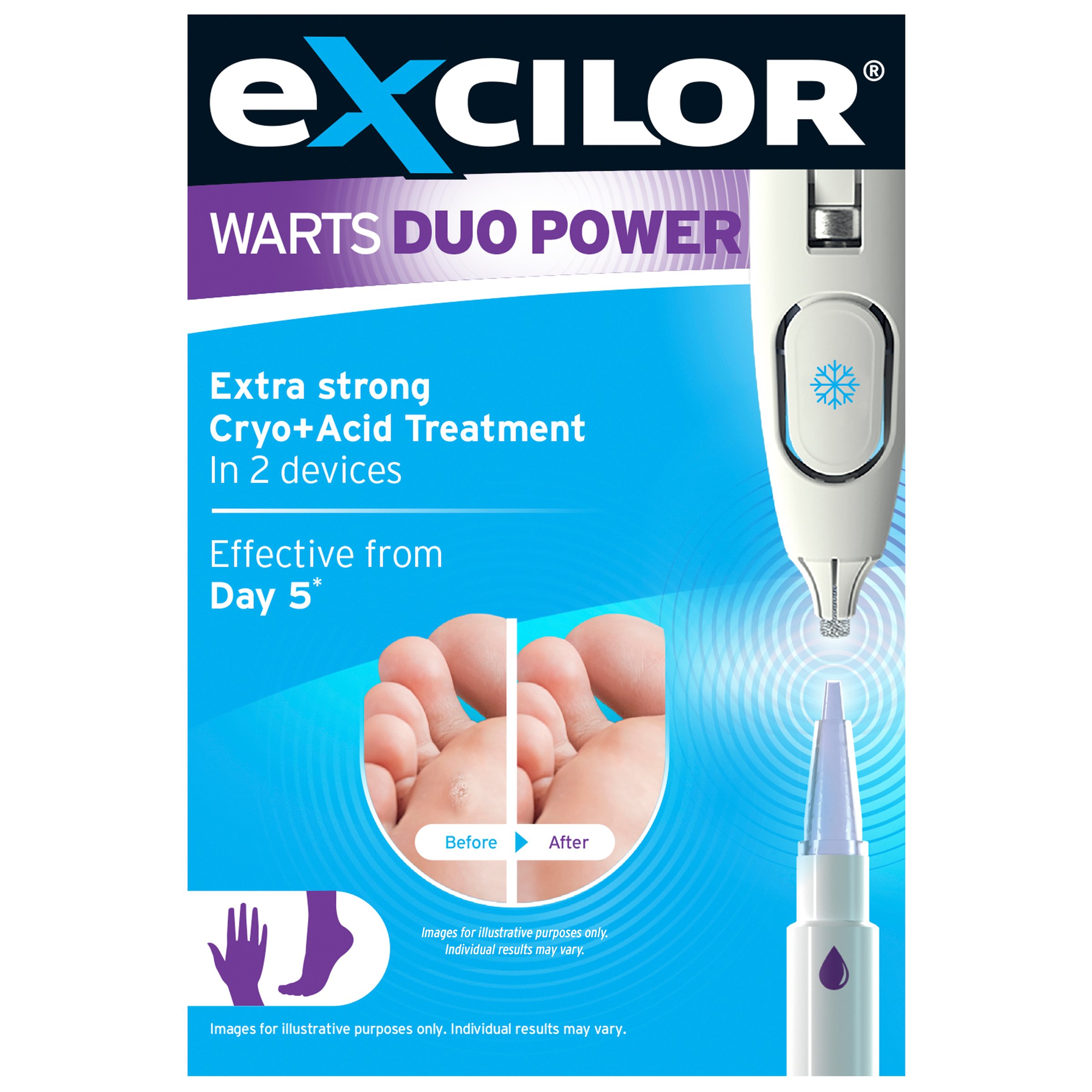 Excilor Warts Duo Power 10ml - Image 1