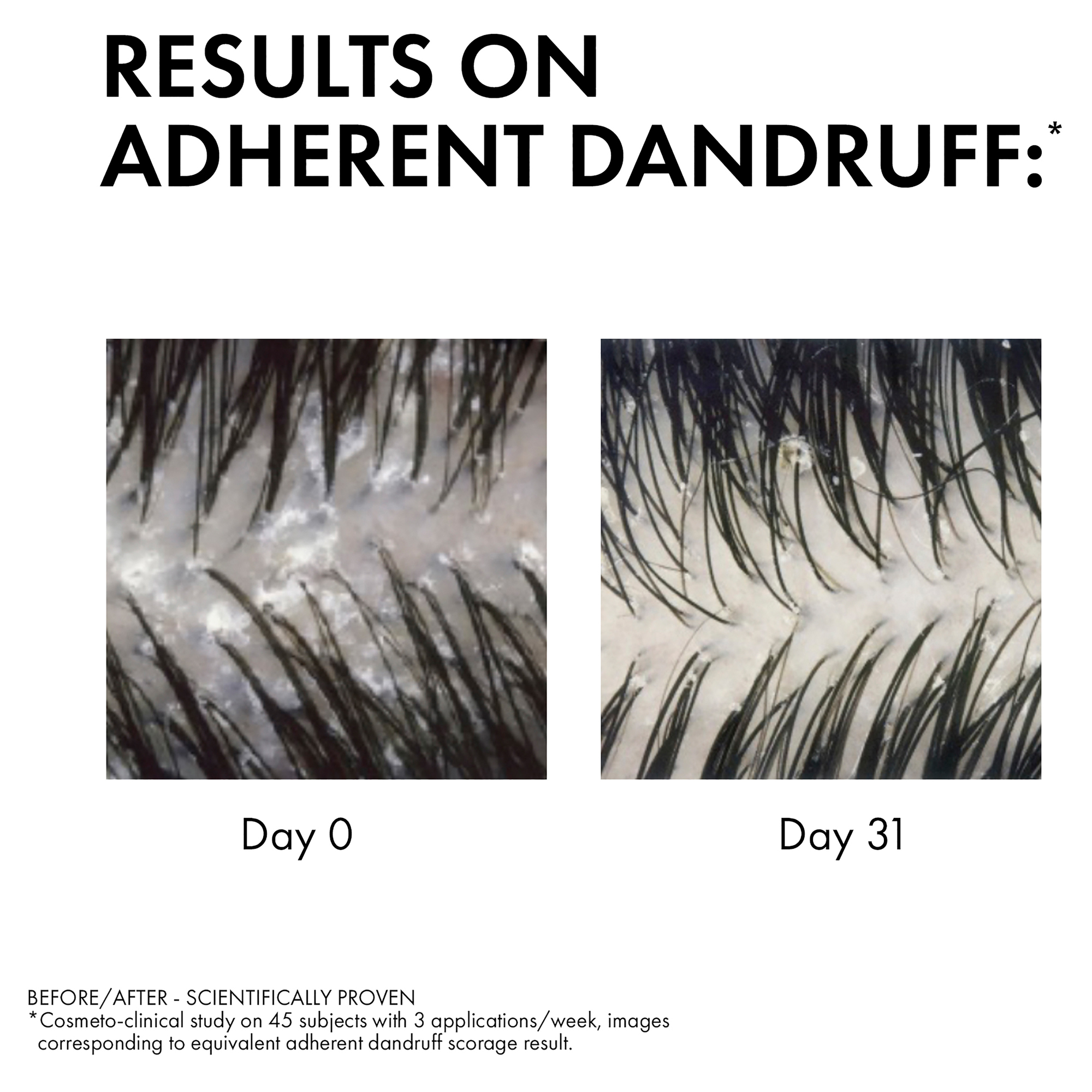 Dercos Anti-Dandruff Shampoo - Sensitive Scalp 200ml - Image 3
