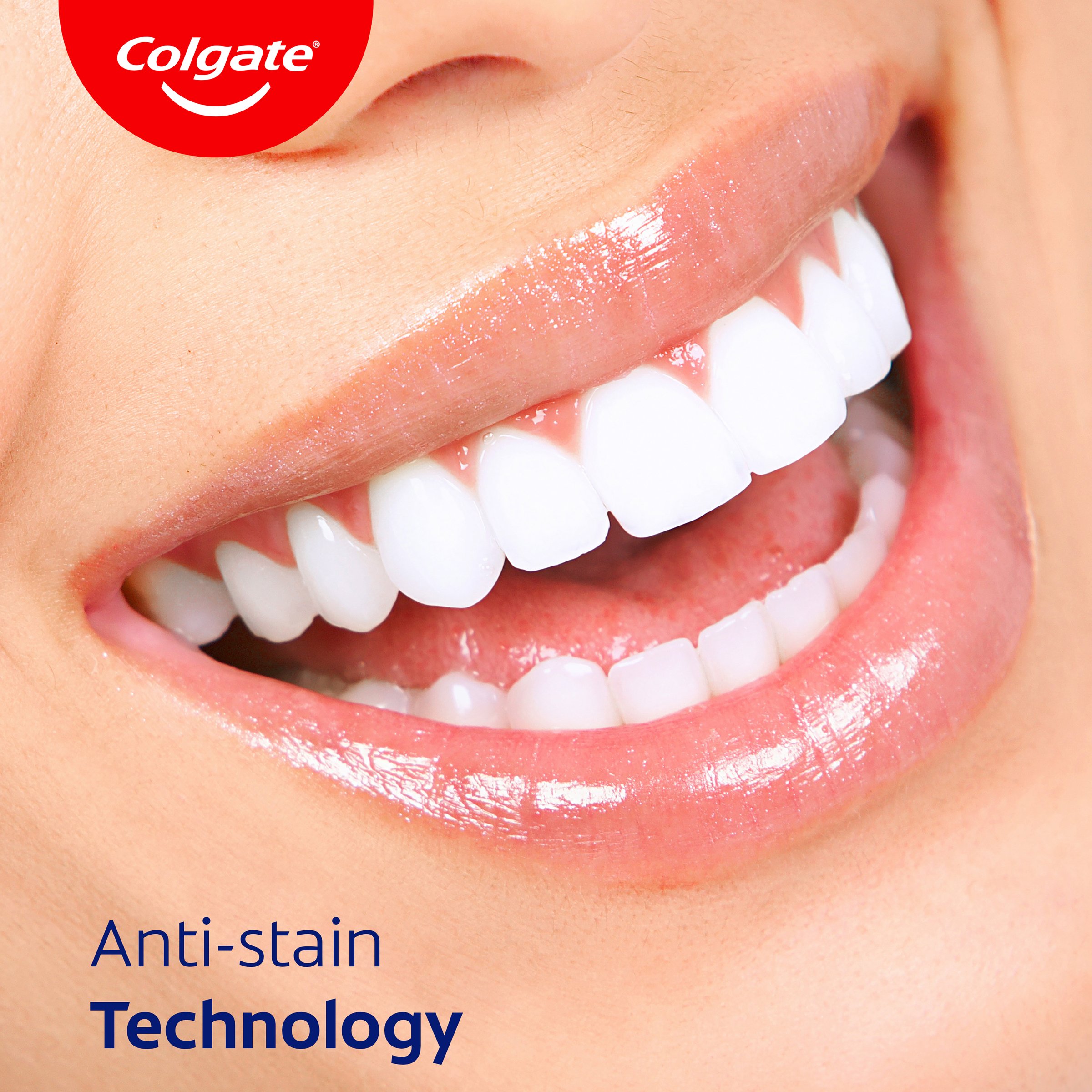 Colgate Savacol Low Stain 300 ml - Image 6