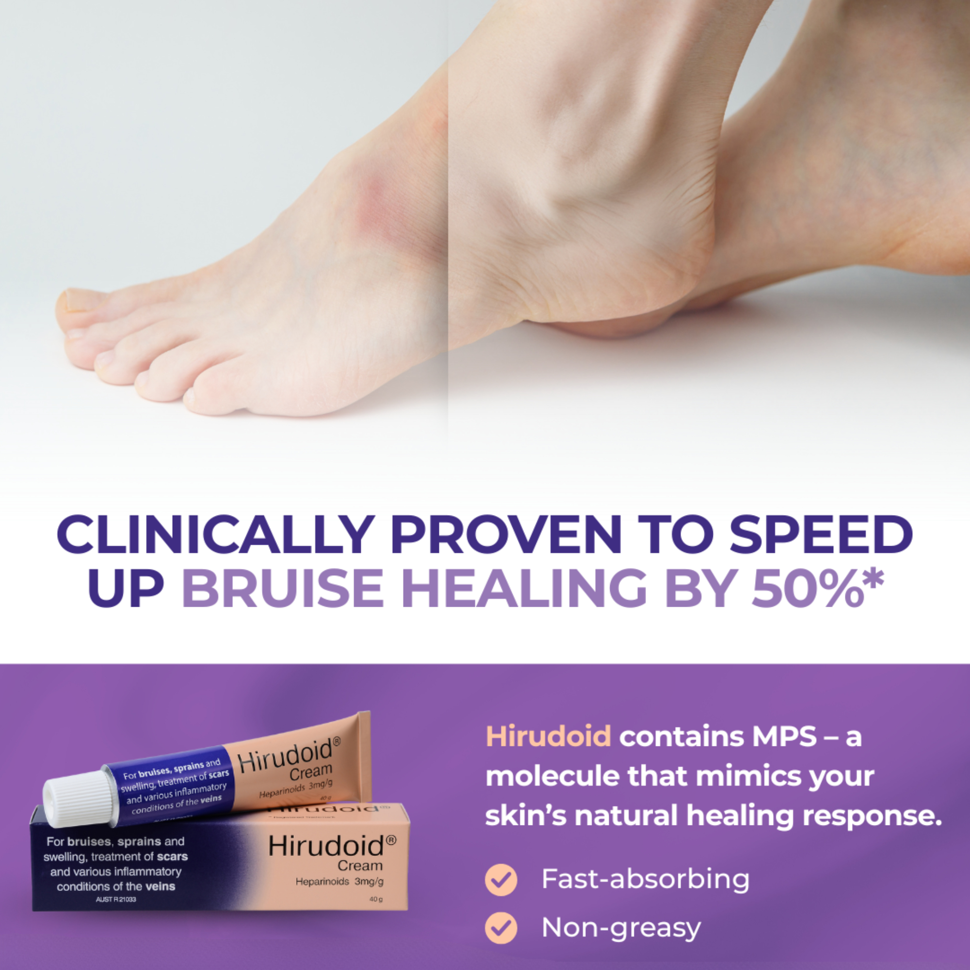 Hirudoid Cream 20g - Image 2