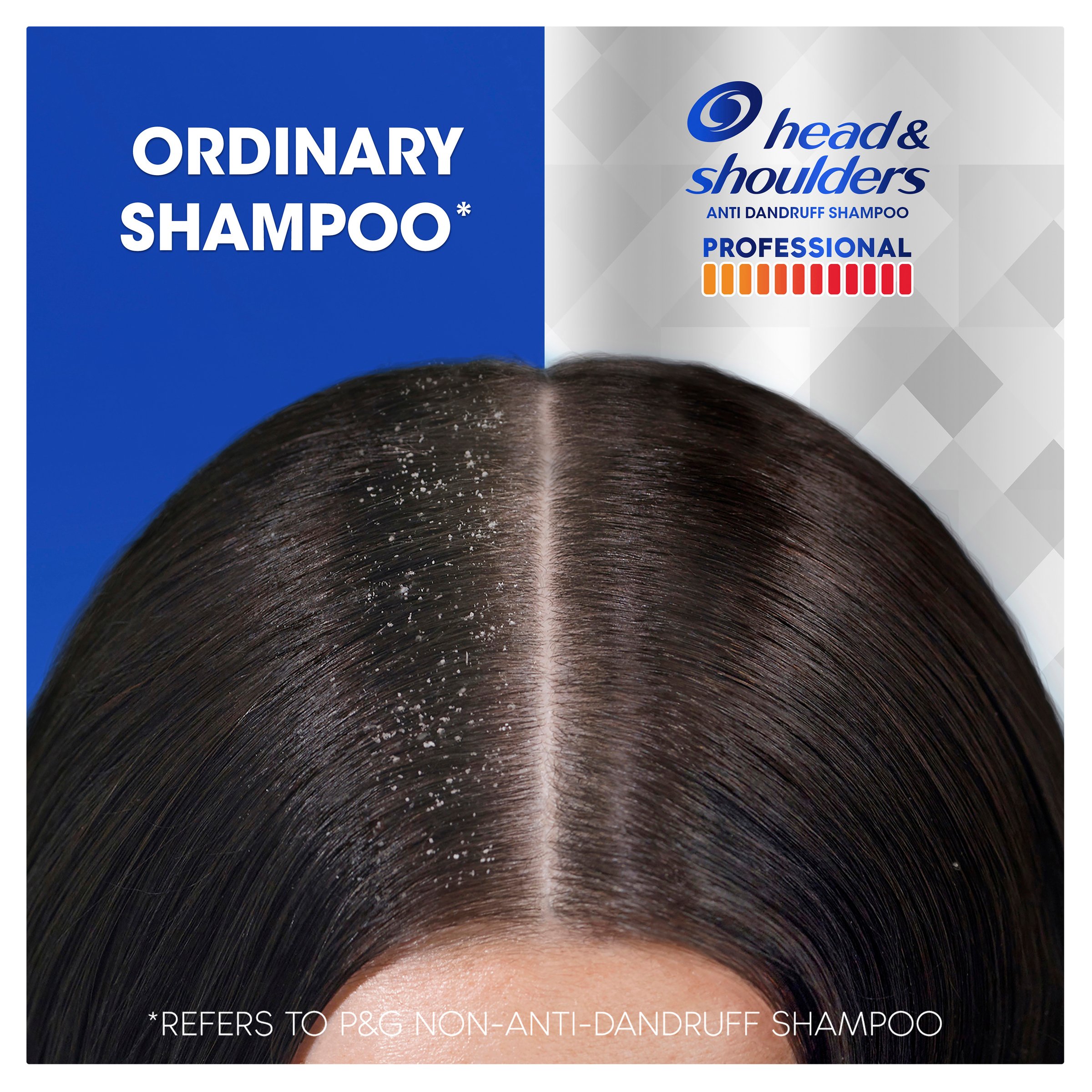 Head & Shoulders Advanced Itch Care Shampoo 300ml - Image 7