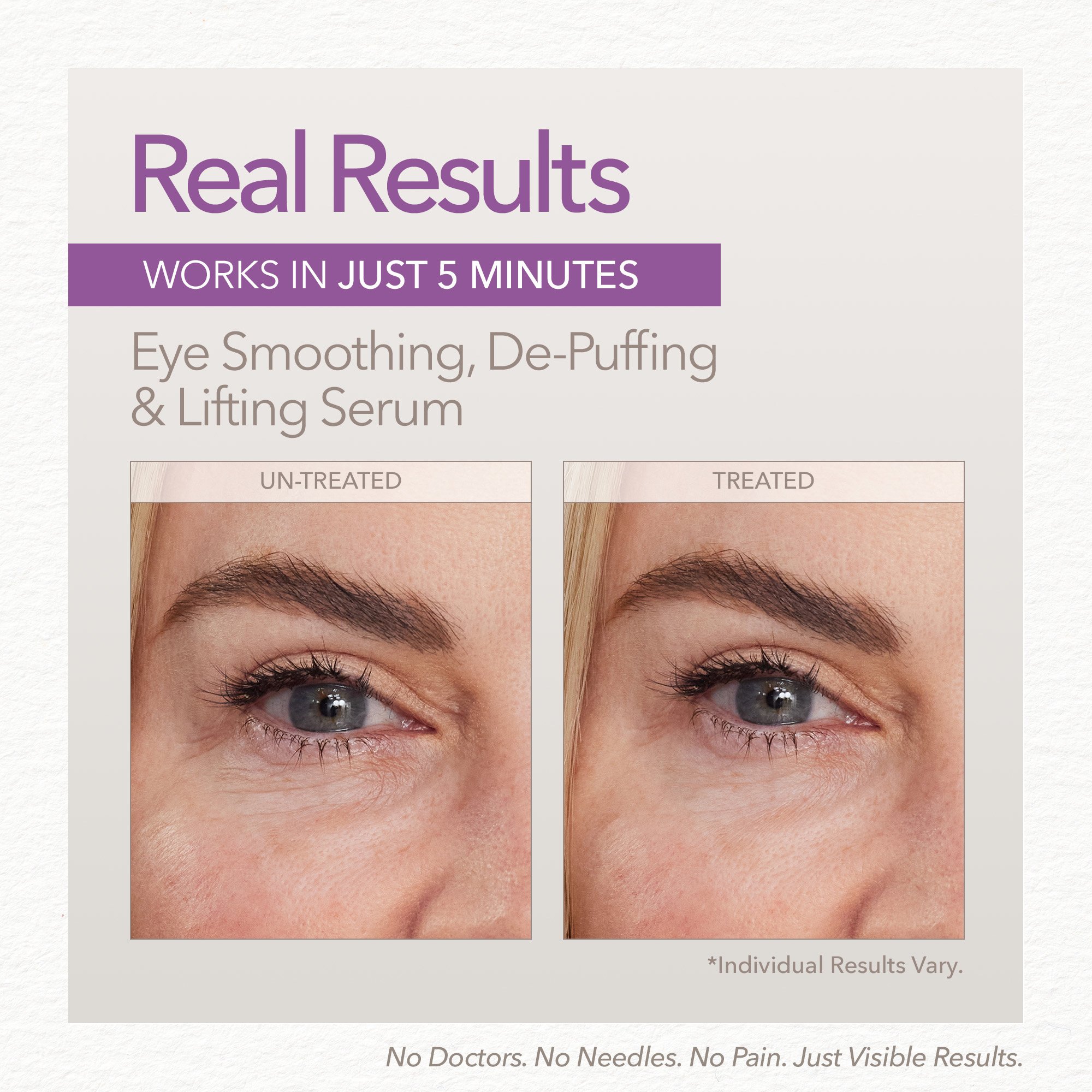 Skin Doctors Instant Eyelift 10ml - Image 5