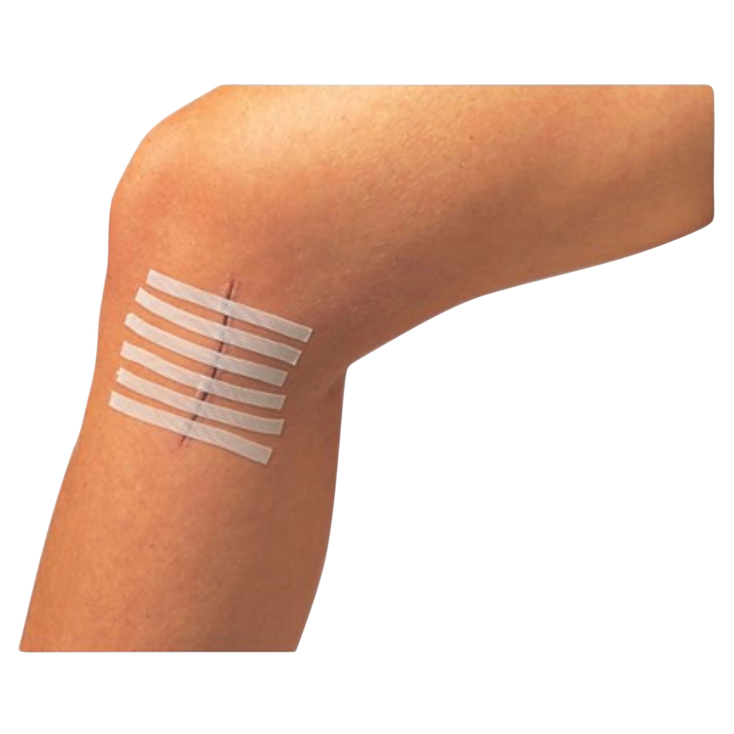 Leukostrip Wound Closure Strips 6.4mm X 76mm - 1 each - Image 2