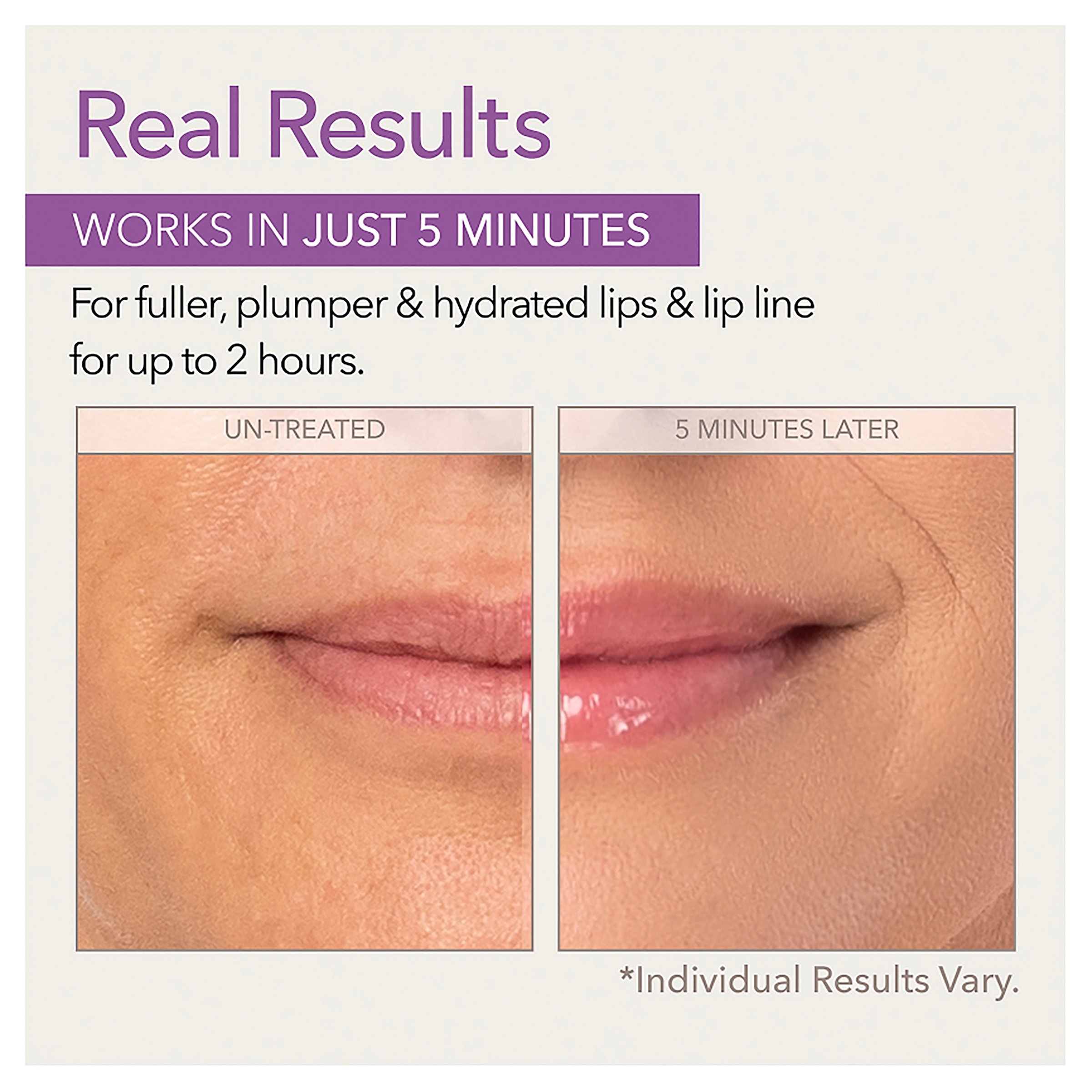 Skin Doctors Instant Lip Plumper 3ml - Image 5