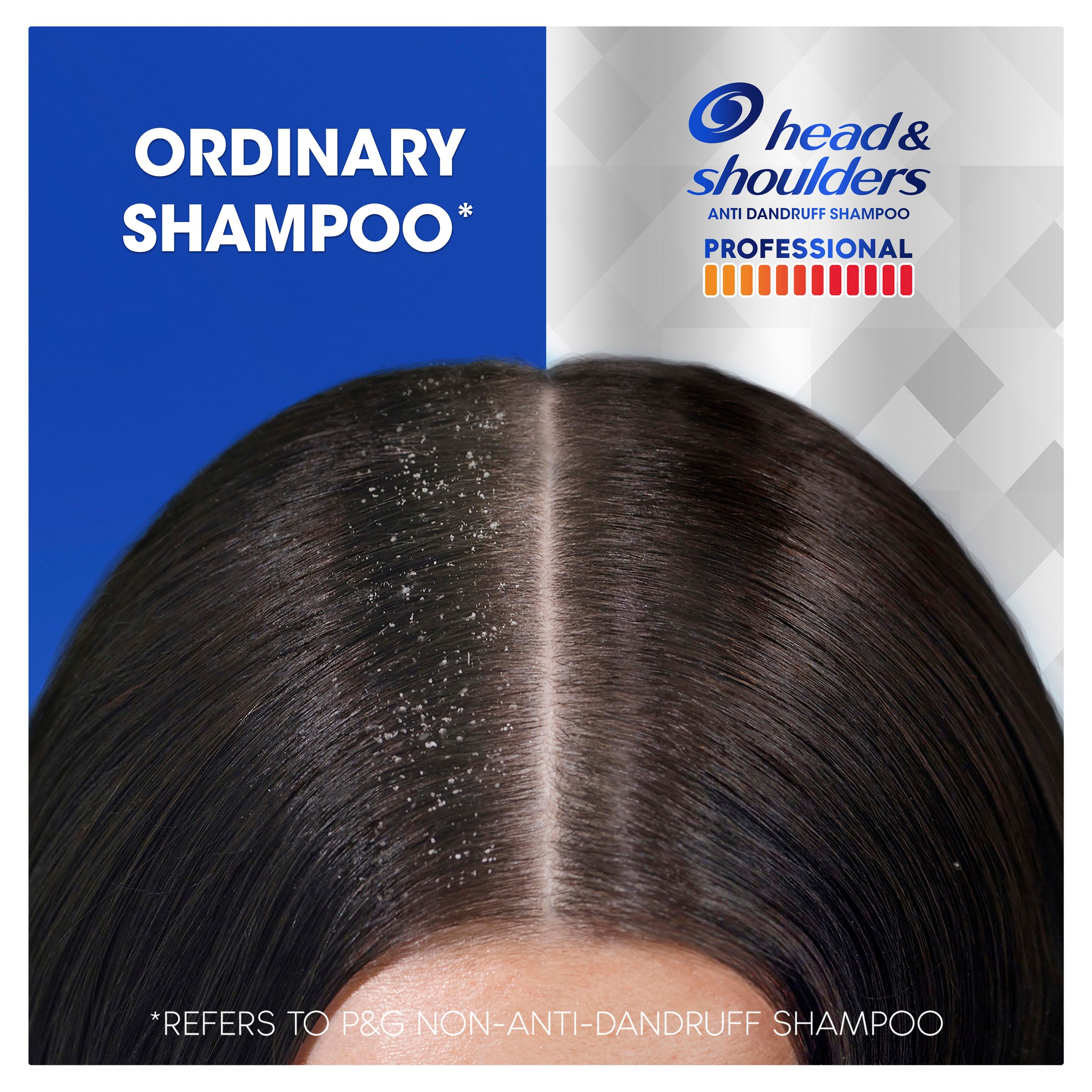 Head & Shoulders Advanced Soothing Care Spray 100ml - Image 8