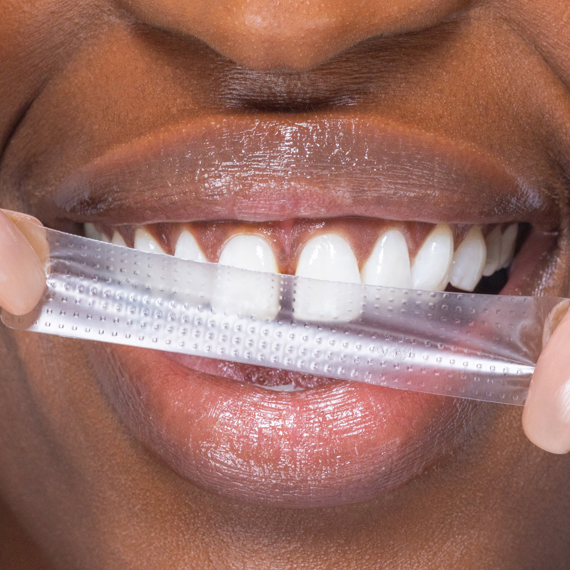Hismile PAP+ Teeth Whitening Strips 7 pack - Image 4