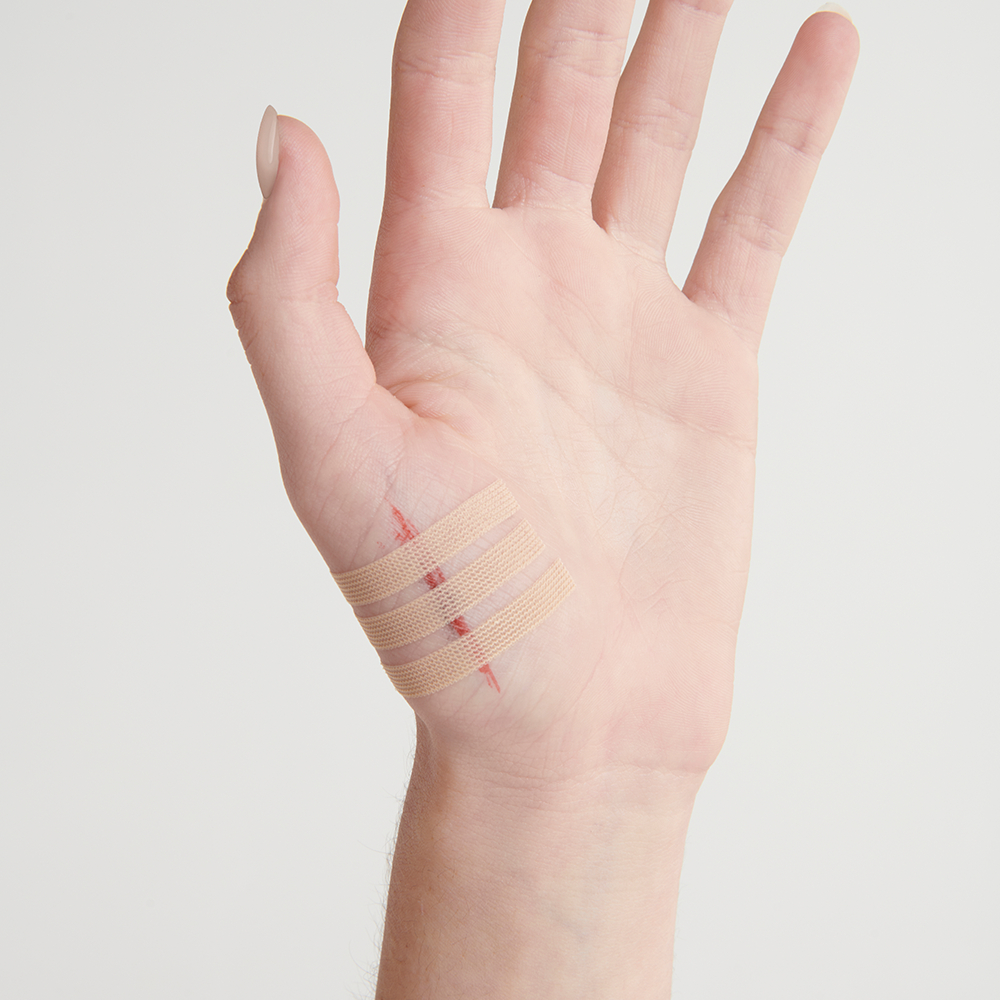 Leukostrip Wound Closure Strips 6.4mm X 76mm - 3 pack - Image 4