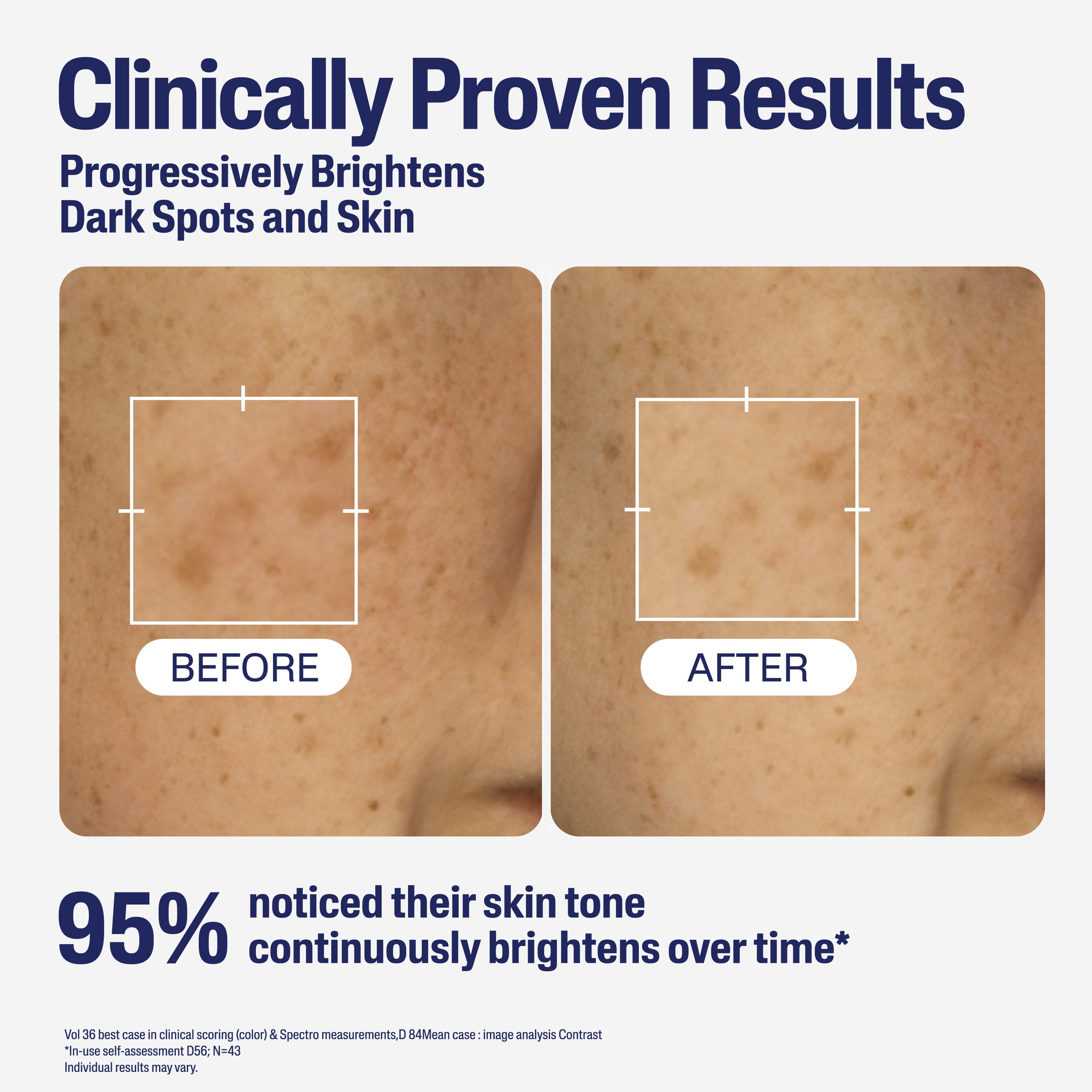 Cetaphil Bright Healthy Radiance Perfecting Serum 30ml - Image 8